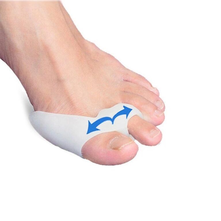 skechers bunion corrector