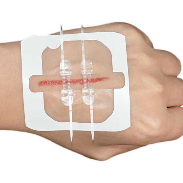 2Pcs Band-aid Zip Stitches10.jpg