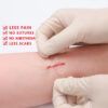 2Pcs Band-aid Zip Stitches12.jpg