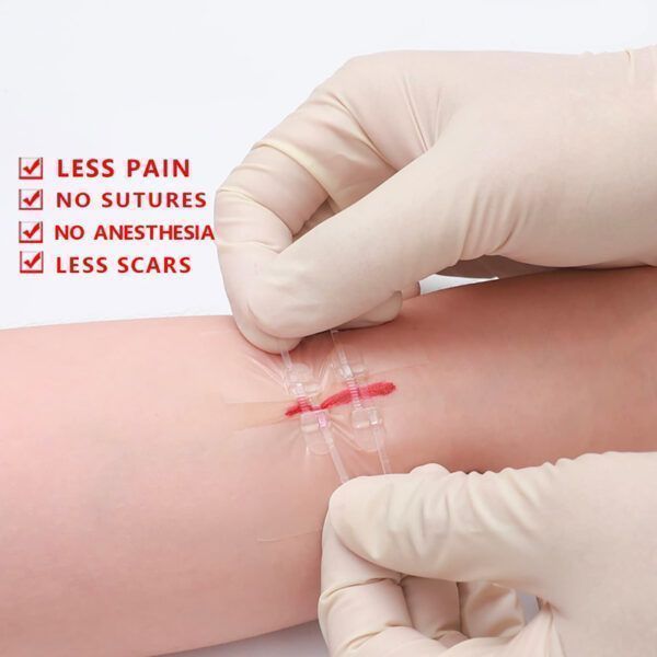 2Pcs Band-aid Zip Stitches12.jpg