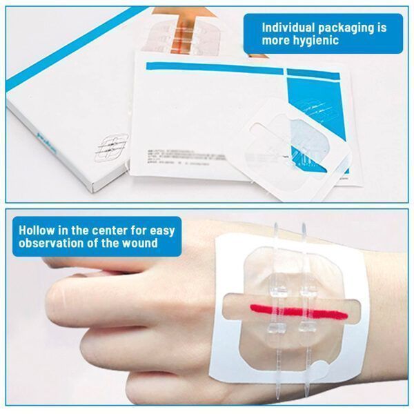 2Pcs Band-aid Zip Stitches15.jpg