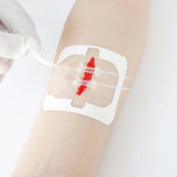 2Pcs Band-aid Zip Stitches5.jpg