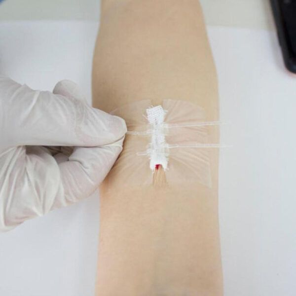 2Pcs Band-aid Zip Stitches6.jpg